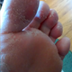 Nasty toesies!